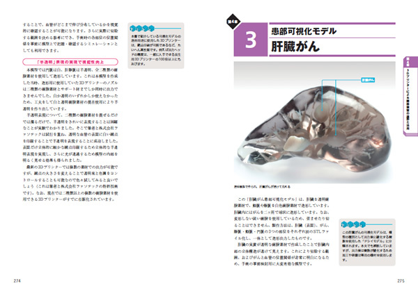 「第4章 3Dプリンターによる臓器模型の造形と活用」より。著者が実際に作成してきた臓器模型の具体例を、そのノウハウとともに多数解説しています